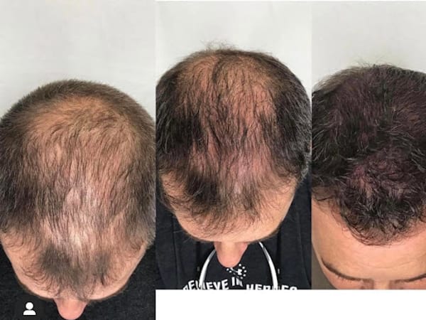 RNA Medical Aesthetics