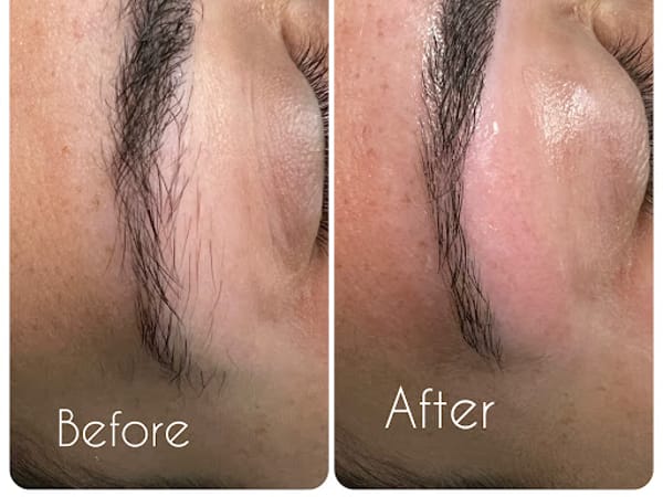 Derma Laser Center Inc