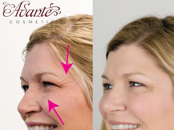 Avante Cosmetic