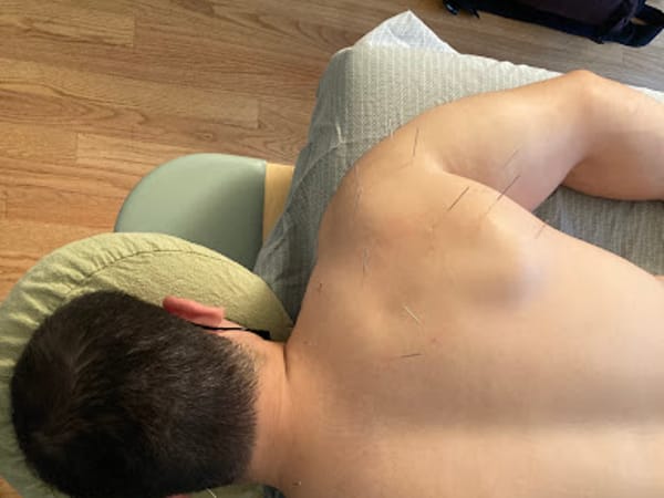 John Ditmars, LAc. - Integrative Acupuncture