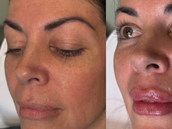 Purple Basil Medspa