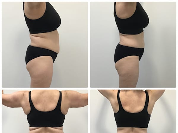 SDBotox - Killeen