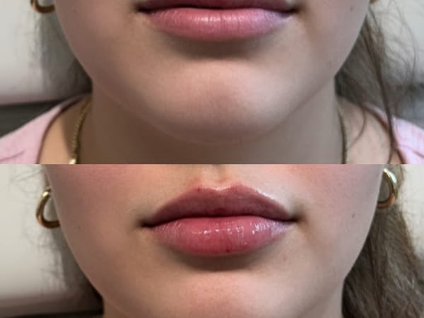 Add Beauty Med Spa | Huntington Beach