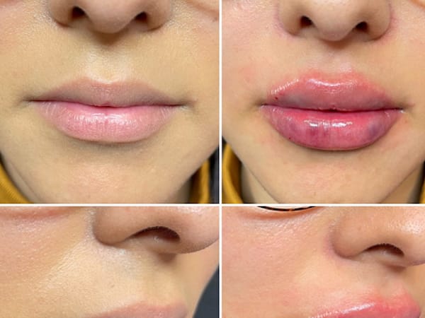 Belle Medical Aesthetics