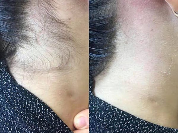 Palm Beach Laser & Aesthetic