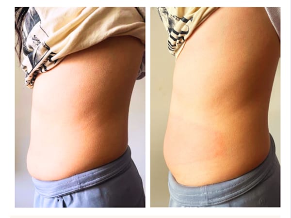 Rose Wellness and Spa- Medspa