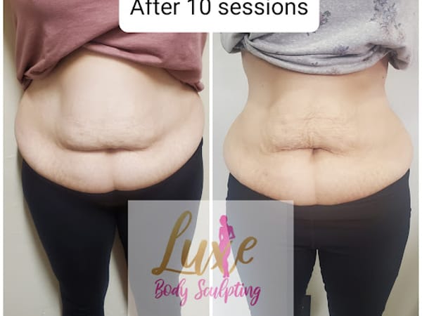 Luxe Body Sculpting