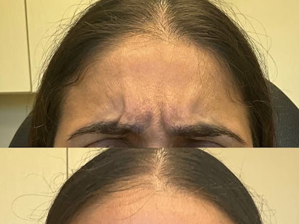 Allumine Skin Clinic