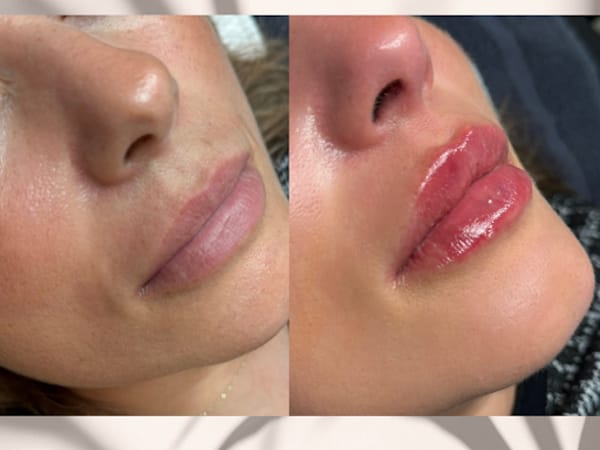 Body Bar by Iri