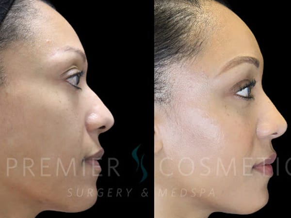 Premier Cosmetic Surgery & Med Spa