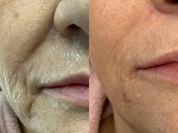 Bombshell Aesthetics and Laser