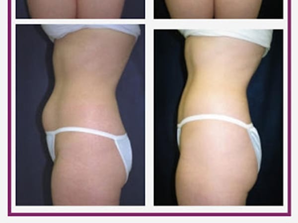 Nashua Plastic Surgery: George P. Chatson, M.D.