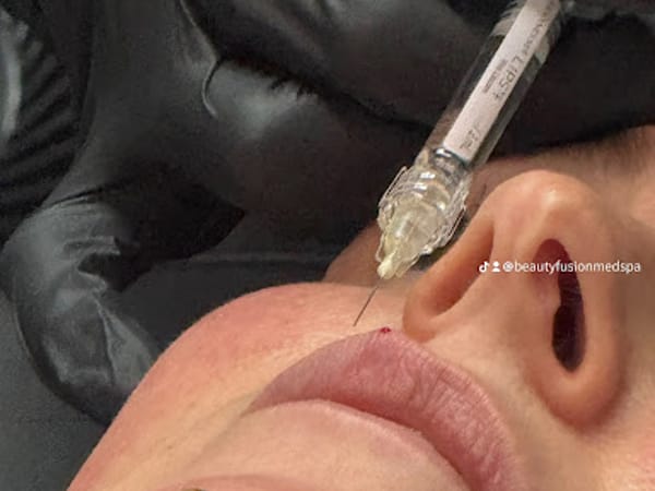 Beauty Fusion Med Spa