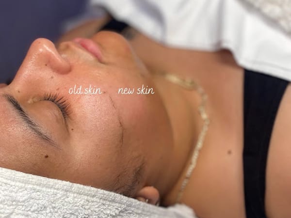 The Skin Lure | Aesthetic | Spa