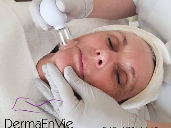 DermaEnVie