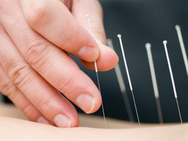 Integrative Acupuncture