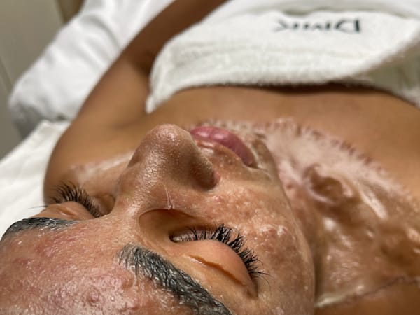 Evolution Skyn Aesthetics - Dermaplaning + Acne Expert + DMK Facialist