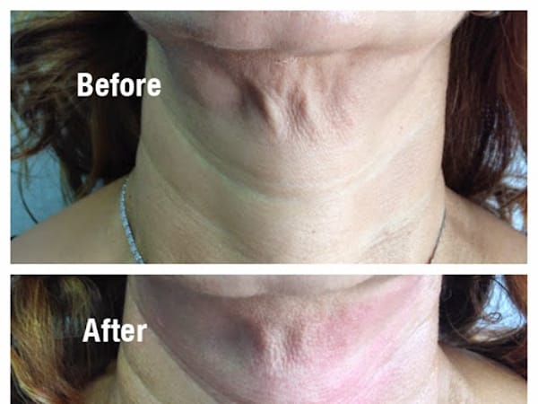 Simply Skin Laser Medispa