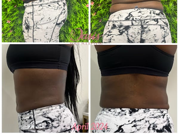 Oasis Body Sculpting