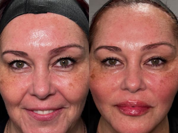Dolce Derm Aesthetics & Wellness Nursing Inc.