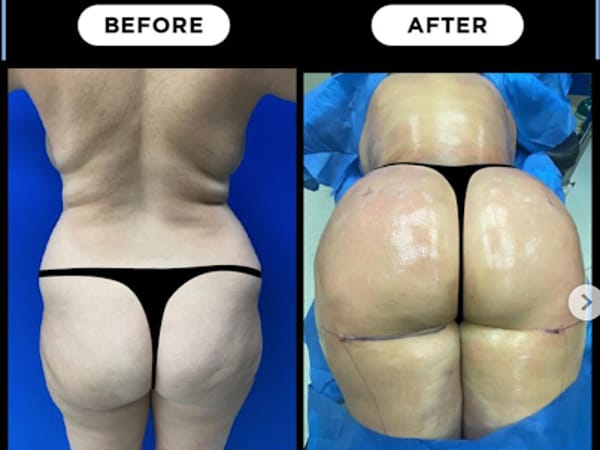 Advanced Body Sculpting of New England - Dr. Mark Lowney