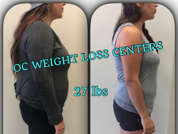 OC Weight Loss & Med Spa
