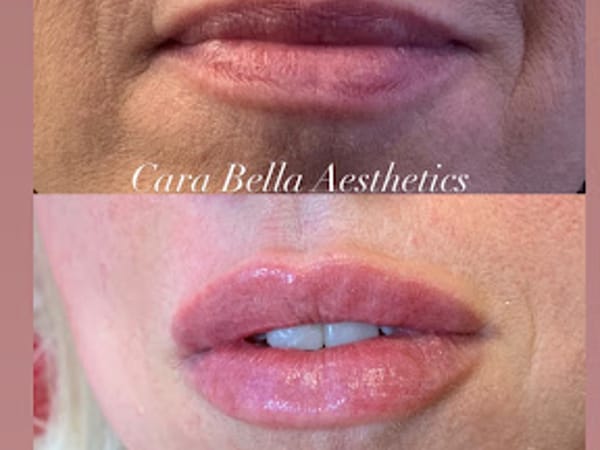 Cara Bella Aesthetics