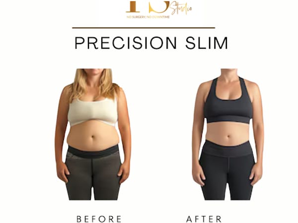 YOUR SCULPT STUDIO - Body & Face Contouring Experts