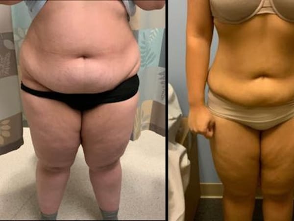 Allure Medical