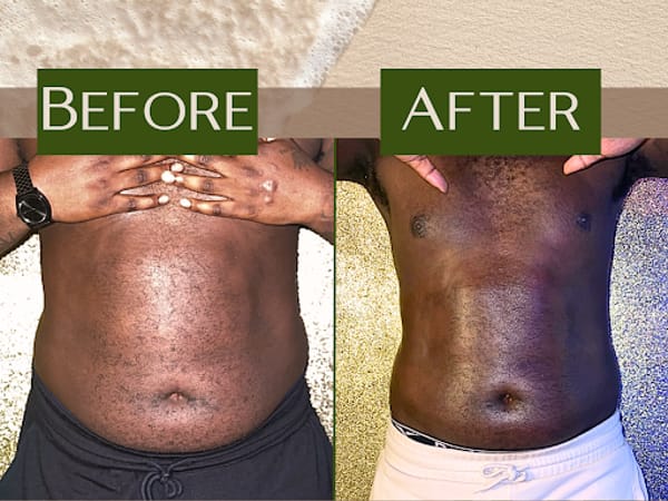 Siren Curves Body Sculpting