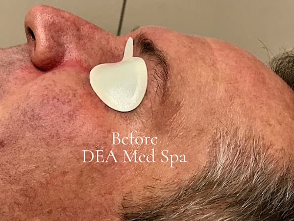 DEA Med Spa
