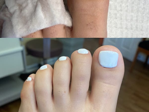 Smith Medical Pedicures