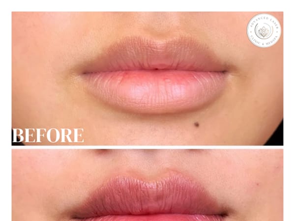 Advanced Laser Clinic And MedSpa
