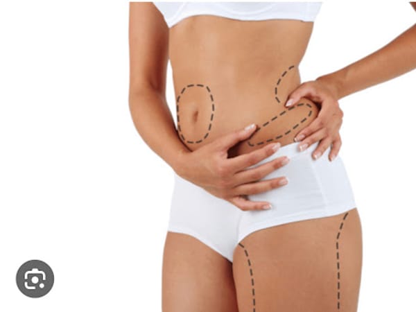 VIP List Laser Lipo & Body Sculpting