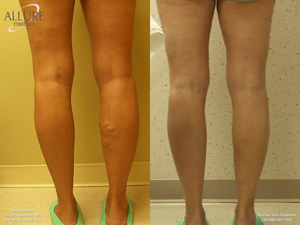 Allure Medical