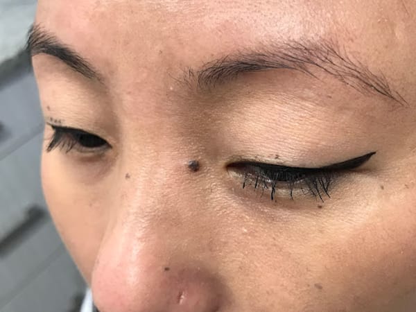 Moksha Dermatology