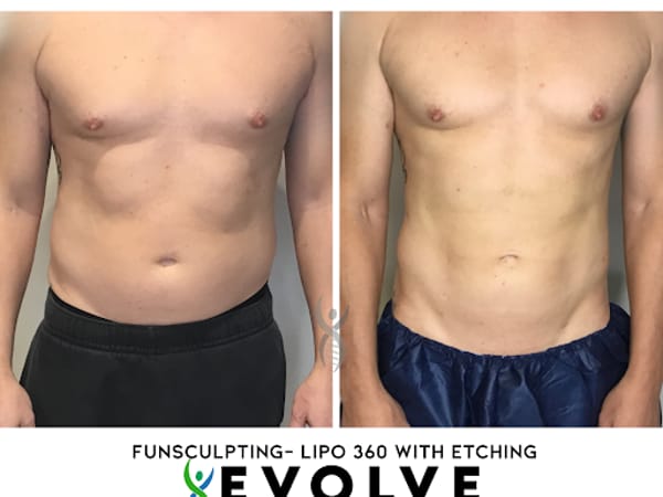 Evolve Aesthetics and Regenerative Medicine