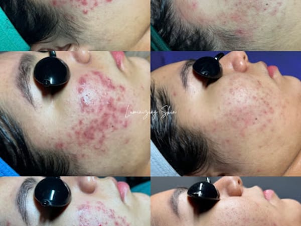 Luminizing Skin