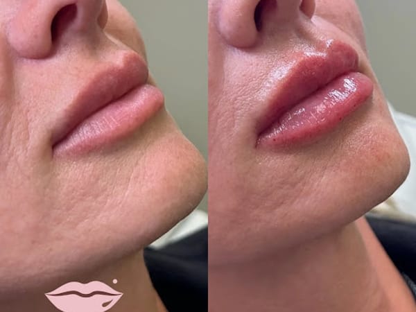 The Beauty Spot MedSpa