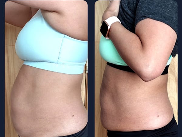 Slim Down Solutions OKC