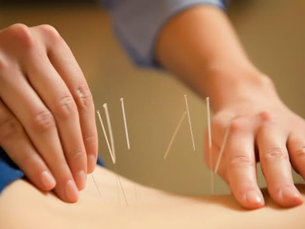 Acupuncture & Alternative Medicine of Staten Island