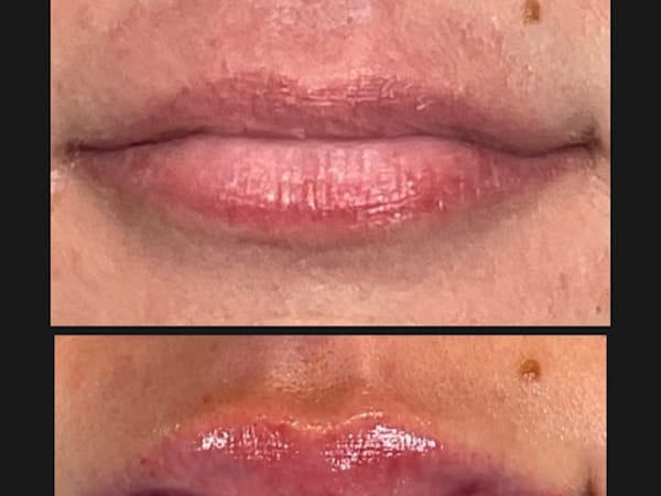 SoHo Skin Renewal, Boutique Medspa