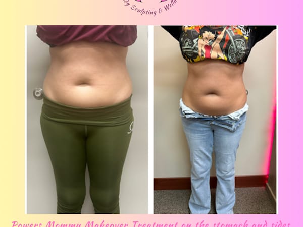 Powers Body Sculpting & Wellness
