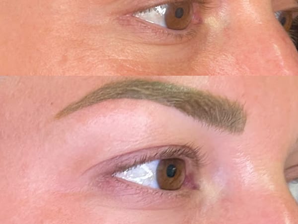 Pure Medspa and Wellness