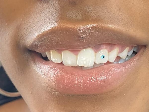 Kurvy Body Works: Body Contouring, Cosmetic Teeth Whitening & Tooth Gems