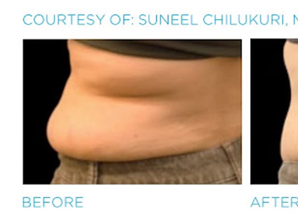 Zormeier Cosmetic Surgery and Longevity Center