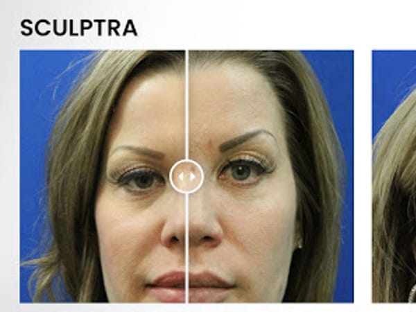 Advanced Regenerative Therapy