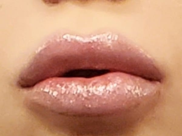 Botox Botixue