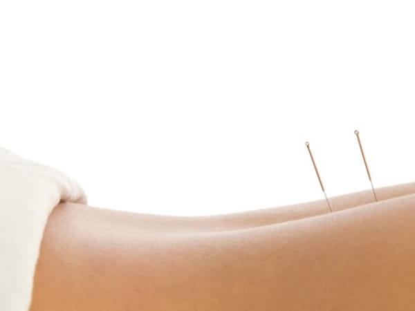 Acupuncture & Integrative Wellness Center