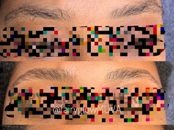 GLOWDEGA | Oakland Acne Experts & Brazilian Sugaring